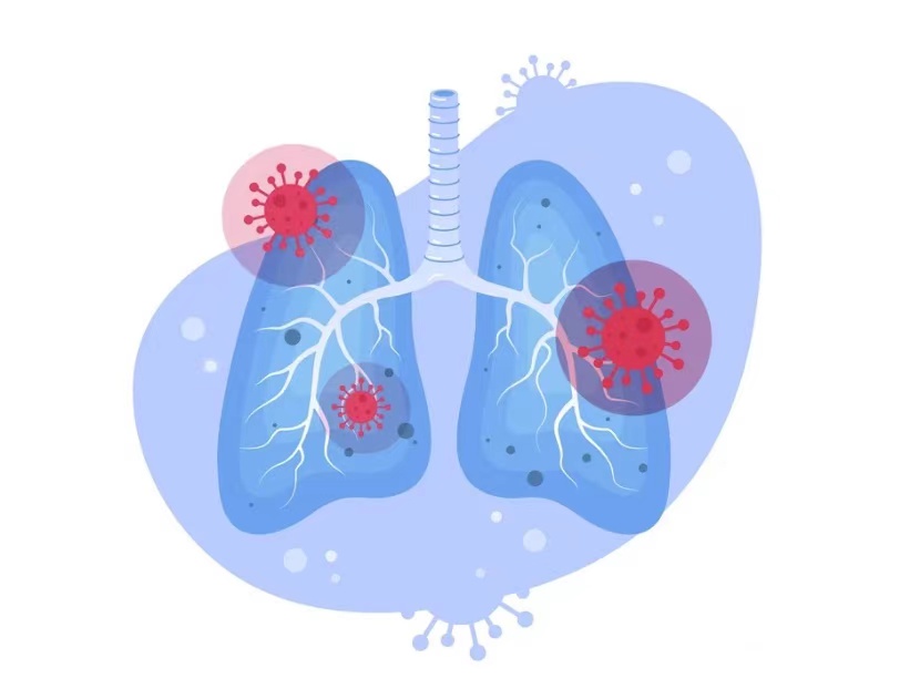 特殊人群警惕!感染出现白肺极其危险! 特殊人群警惕!感染出现白肺极其危险!